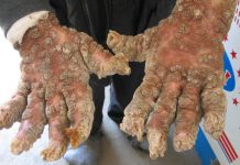 5 lucruri pe care dermatologul nu ti le spune niciodata. Ce iti ascunde specialistul care se ocupa de pielea ta