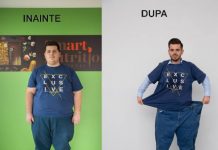 Un tânăr de 26 de ani a slăbit 80 de kilograme fără chirurgie bariatrică